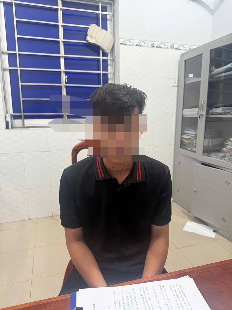 Công an làm việc với 2 người đánh thiếu niên 16 tuổi ở Tây Ninh Công an làm việc với 2 người đánh thiếu niên 16 tuổi ở Tây Ninh