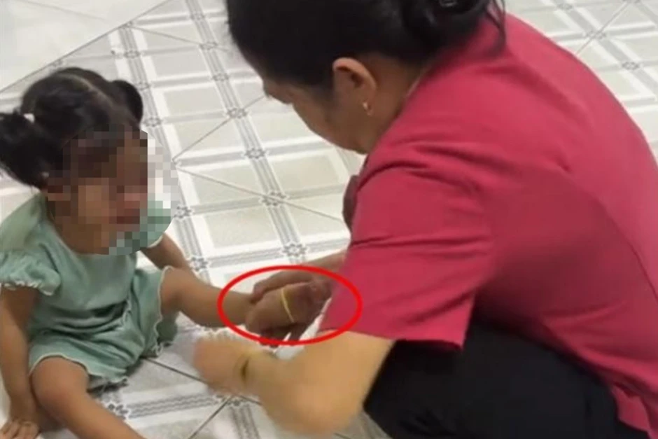 Công an xác minh vụ bảo mẫu đánh chửi, bắn dây thun vào trẻ Công an xác minh vụ bảo mẫu đánh chửi, bắn dây thun vào trẻ