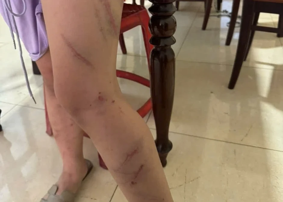 Công an xác minh vụ bé gái 9 tuổi nghi bị mẹ bạo hành Công an xác minh vụ bé gái 9 tuổi nghi bị mẹ bạo hành