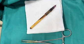 Công an xác minh vụ bé trai lớp 6 ở Hà Nội nghi bị nhét bút vào hậu môn