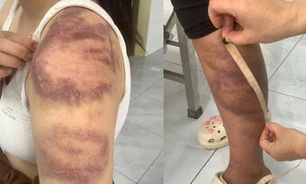 Đánh con gái và vợ mang thai 'như thời trung cổ'