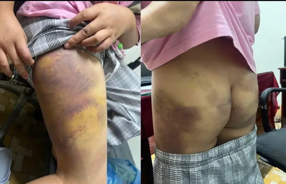 Đồng Nai: Tạm giữ đối tượng bạo hành con gái riêng của người tình Đồng Nai: Tạm giữ đối tượng bạo hành con gái riêng của người tình