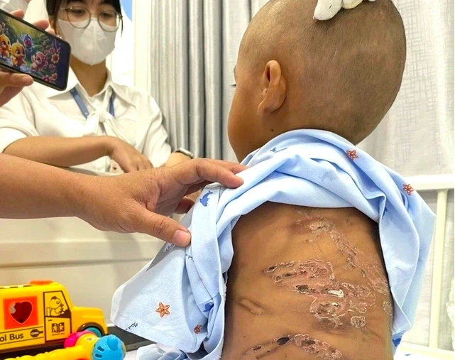 Đừng im lặng với bạo hành trẻ em, hãy gọi tổng đài 111 Đừng im lặng với bạo hành trẻ em, hãy gọi tổng đài 111