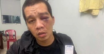 Kẻ cầm đầu đường dây ma túy Đồng Nai - TP.HCM tấn công cảnh sát bằng dao và hơi cay