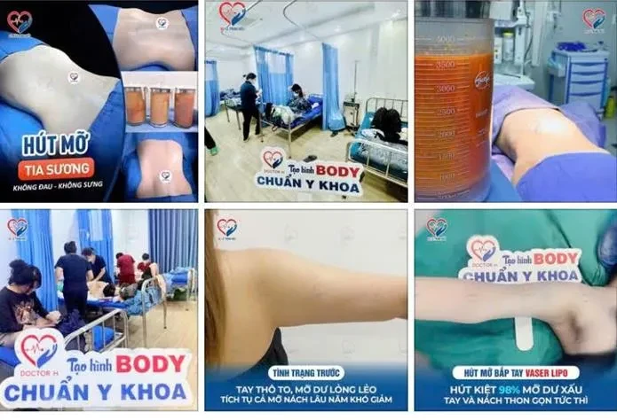 Khởi tố 6 bị can mạo danh bác sĩ, nhân viên y tế gây tê, hút mỡ cho khách Khởi tố 6 bị can mạo danh bác sĩ, nhân viên y tế gây tê, hút mỡ cho khách