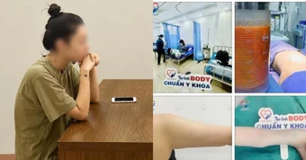 Khởi tố, áp dụng biện pháp ngăn chặn với 6 nhân viên tại cơ sở thẩm mỹ Julia Aesthetic