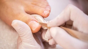 Kiện bác sĩ vì hoại tử chân khi đi cắt khóe móng