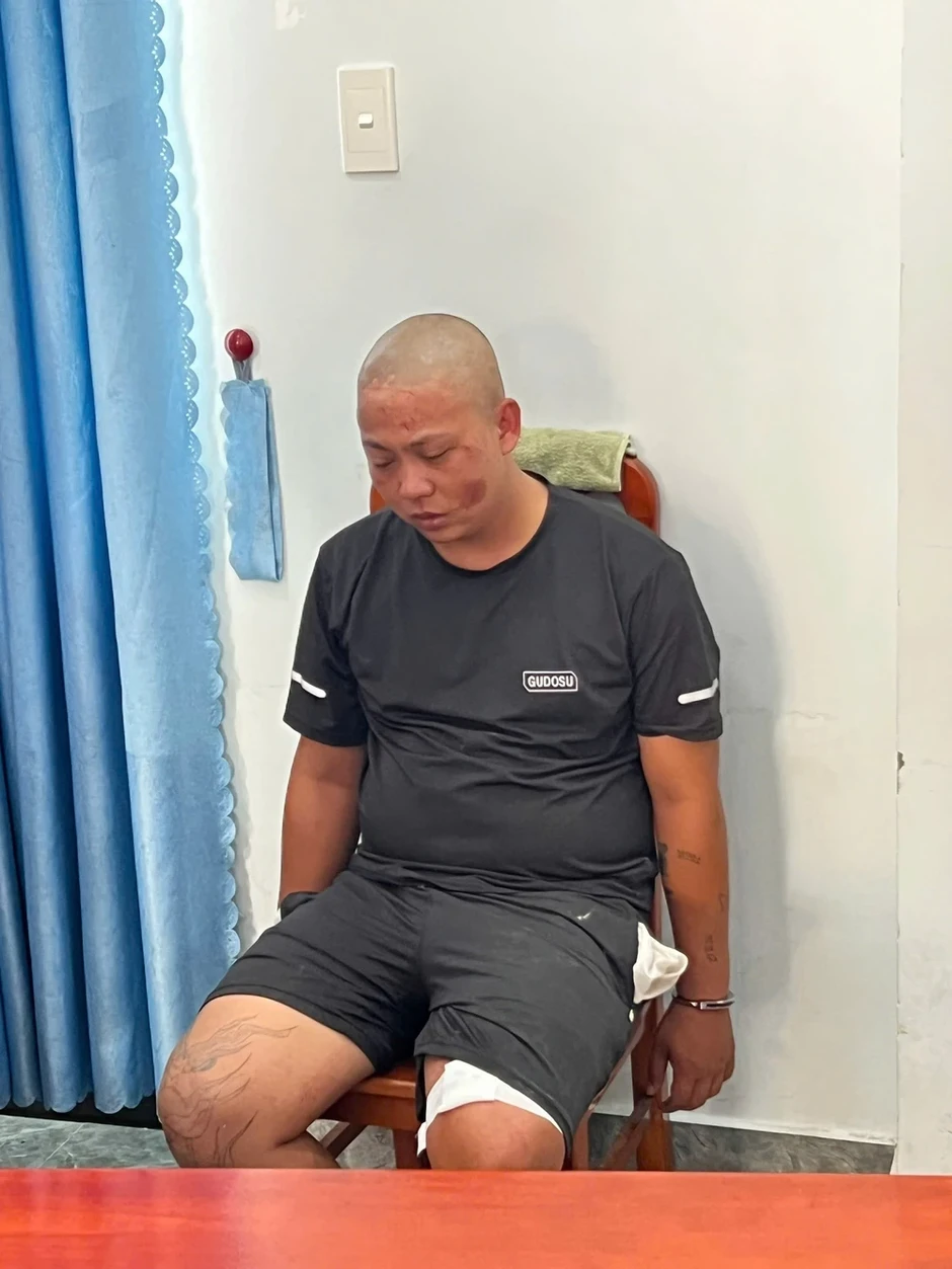 Một cán bộ Công an phường Ba Đồn bị chém trọng thương tại trụ sở Một cán bộ Công an phường Ba Đồn bị chém trọng thương tại trụ sở