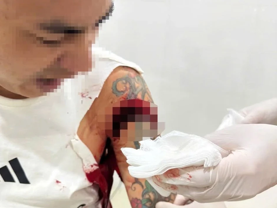 Người đàn ông bị chém trọng thương khi đang ngồi uống cà phê Người đàn ông bị chém trọng thương khi đang ngồi uống cà phê
