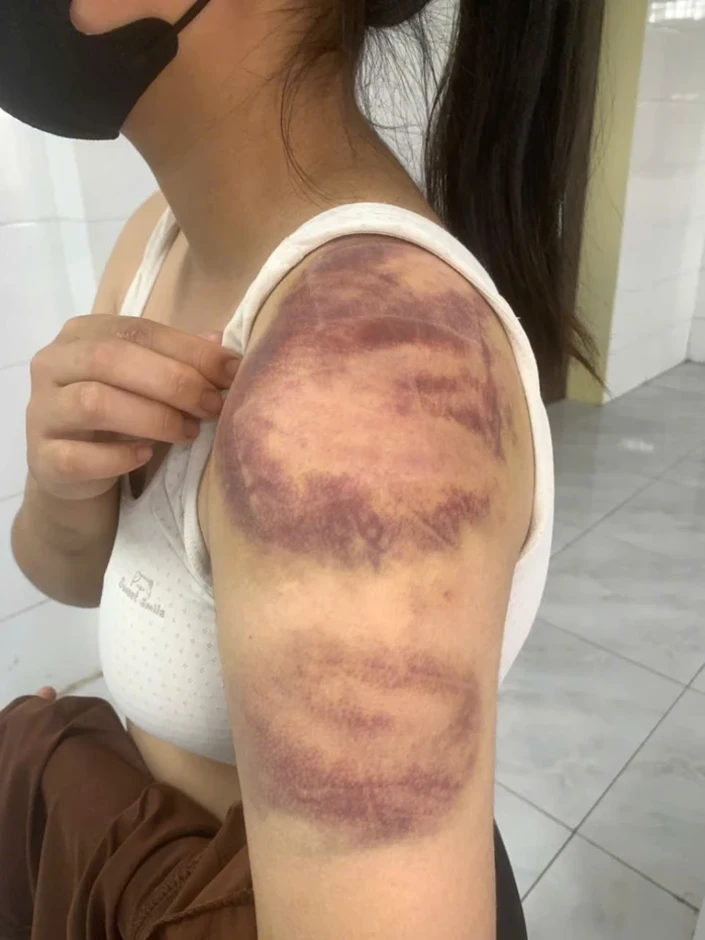 Người đàn ông nhiều lần trói, đánh đập con, vợ đang mang thai trong ngày Tết Người đàn ông nhiều lần trói, đánh đập con, vợ đang mang thai trong ngày Tết