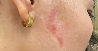 Người phụ nữ bị xăm lên mặt do ghen tuông kháng cáo toàn bộ bản án