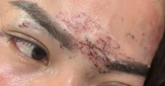 Người phụ nữ bị xăm lên mặt nghi do ghen tuông kháng cáo toàn bộ bản án