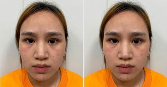 Nguyễn Thị Diễm Thúy SN 2005 đã ra đầu thú