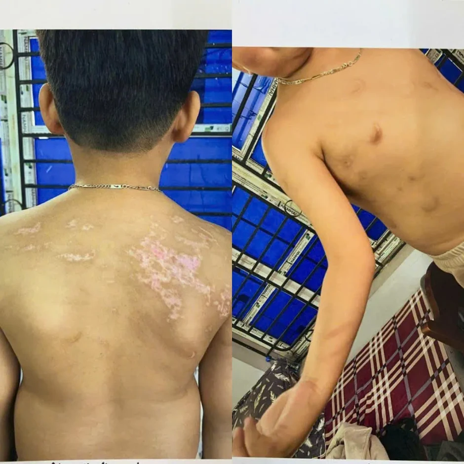 Phú Thọ: Khởi tố đối tượng bạo hành con ruột gây thương tích 36% Phú Thọ: Khởi tố đối tượng bạo hành con ruột gây thương tích 36%