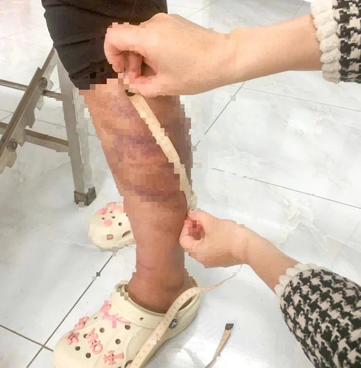 Tạm giam người đàn ông nhiều lần trói, đánh con gái và vợ đang mang thai