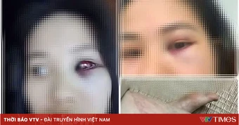 Thầy giáo THPT bị tố có con riêng, bạo hành vợ: Công an vào cuộc xác minh