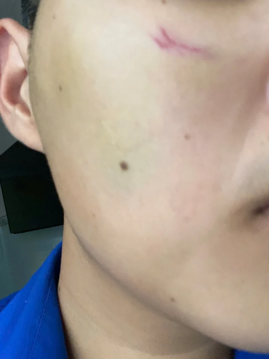 Thiếu niên 16 tuổi bị hành hung trên đường đi học về Thiếu niên 16 tuổi bị hành hung trên đường đi học về
