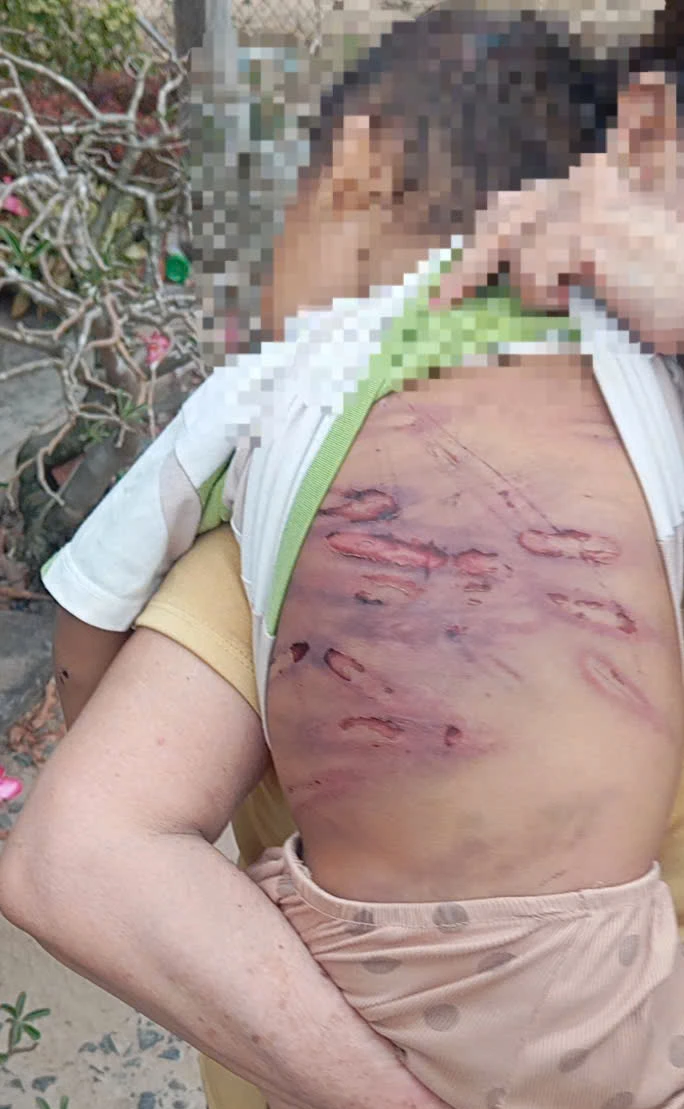TP Hồ Chí Minh bắt giữ 2 đối tượng liên quan vụ bạo hành trẻ em