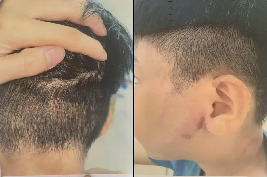 Triệu tập người cha nghi đánh con ruột nhập viện Triệu tập người cha nghi đánh con ruột nhập viện