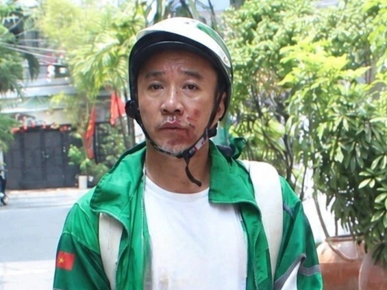 Tướng cướp Hoàng “Bác Sĩ” sa lưới sau vụ giật túi xách ở TPHCM Tướng cướp Hoàng “Bác Sĩ” sa lưới sau vụ giật túi xách ở TPHCM