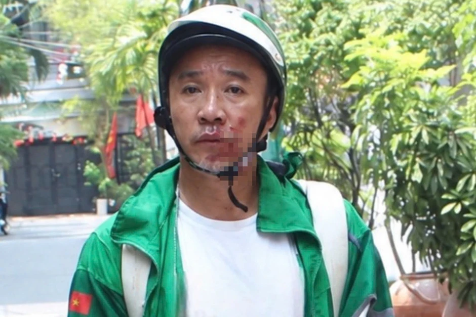 Tướng cướp Hoàng 'Bác sĩ' và lần bị bắt sau gần 20 năm Tướng cướp Hoàng 'Bác sĩ' và lần bị bắt sau gần 20 năm