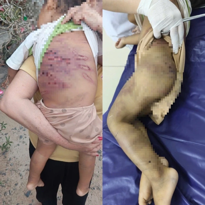 Vụ bạo hành bé trai 2 tuổi ở TPHCM: Cần bảo vệ quyền lợi trẻ em Vụ bạo hành bé trai 2 tuổi ở TPHCM: Cần bảo vệ quyền lợi trẻ em