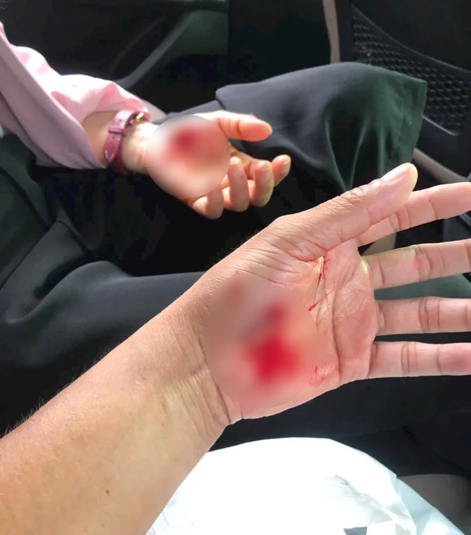 Xã Nhà Bè, TP.HCM: Người dân khốn khổ, bị tai nạn vì chó thả rông Xã Nhà Bè, TP.HCM: Người dân khốn khổ, bị tai nạn vì chó thả rông