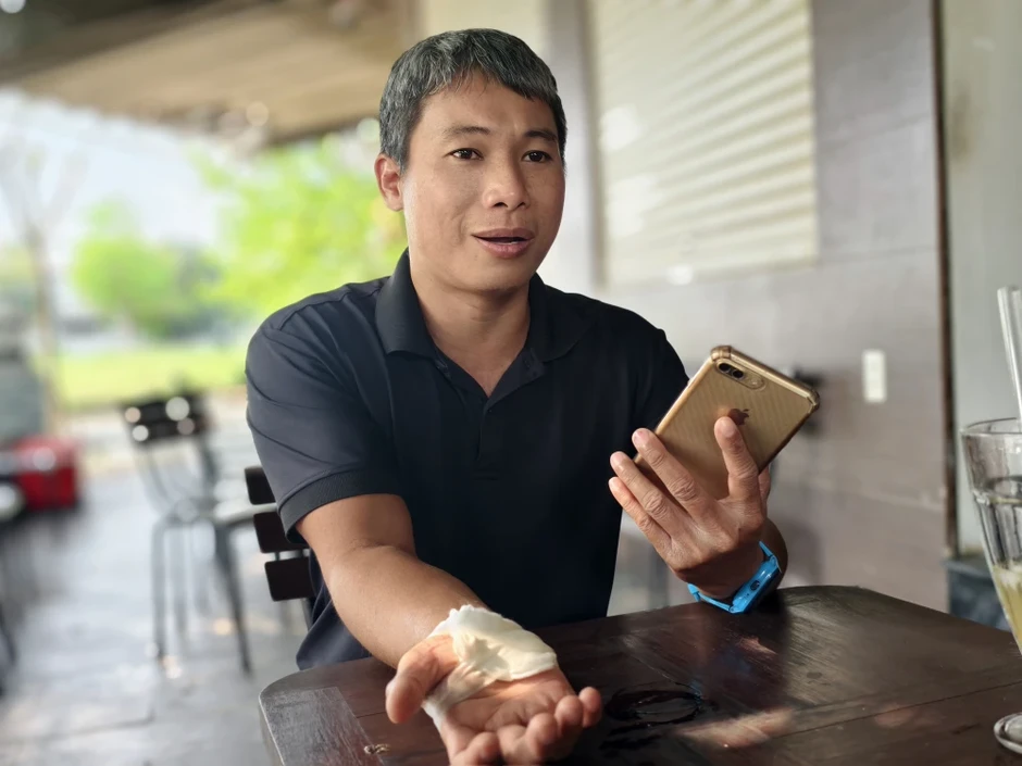 Xã Nhà Bè, TP.HCM: Người dân khốn khổ, bị tai nạn vì chó thả rông Xã Nhà Bè, TP.HCM: Người dân khốn khổ, bị tai nạn vì chó thả rông