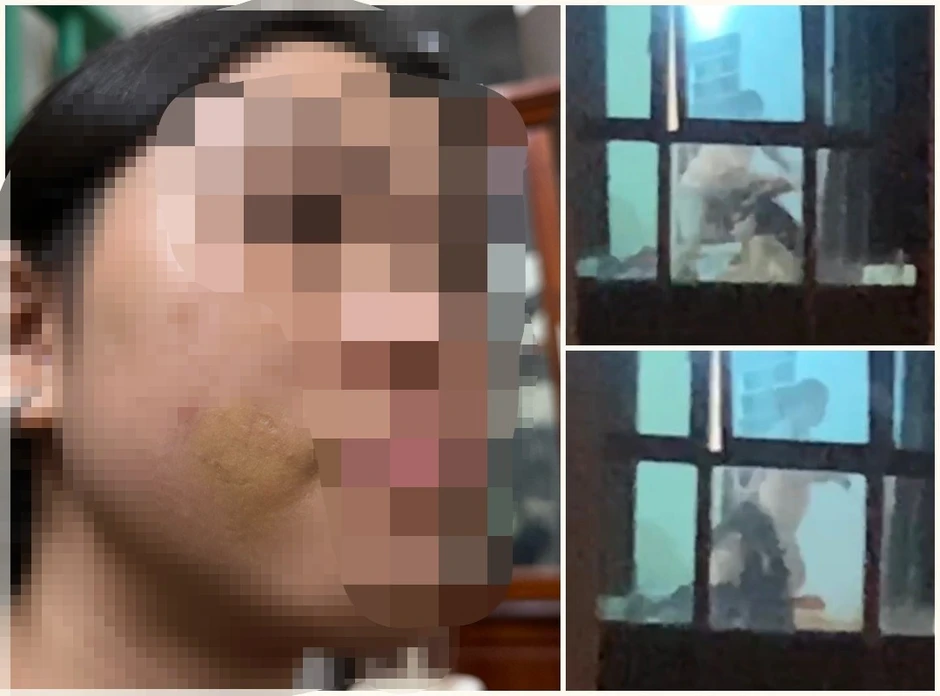 Xác minh vụ bé gái bị mẹ kế bạo hành ở Phú Thọ Xác minh vụ bé gái bị mẹ kế bạo hành ở Phú Thọ