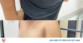 Xử phạt thanh niên bịa chuyện bị cướp 40 triệu đồng, tự dựng hiện trường giả