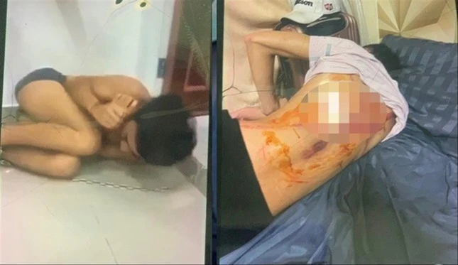 Nhức nhối nạn buôn người : Chiêu trò ' bẫy ' người trên mạng Nhức nhối nạn buôn người : Chiêu trò ' bẫy ' người trên mạng