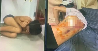 Nhức nhối nạn buôn người : Chiêu trò ' bẫy ' người trên mạng