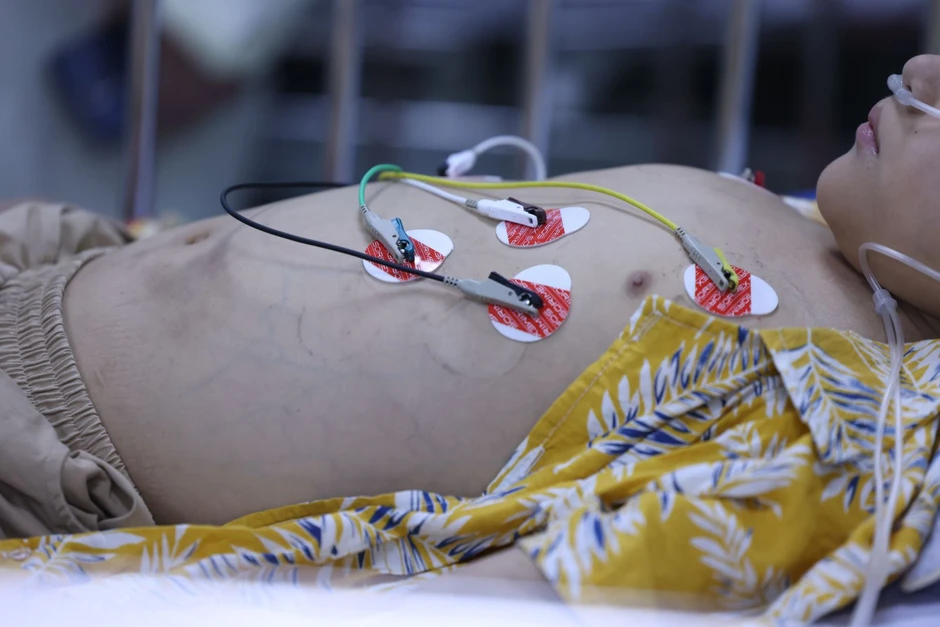 Những người không có Tết do sốt xuất huyết Dengue Những người không có Tết do sốt xuất huyết Dengue