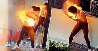 Khoảnh khắc sạc dự phòng bất ngờ phát nổ khiến cô gái bị bỏng nặng