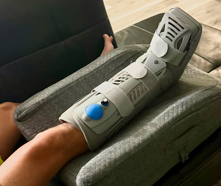 Ca sĩ Mạnh Quỳnh bị vỡ xương mắt cá chân Ca sĩ Mạnh Quỳnh bị vỡ xương mắt cá chân