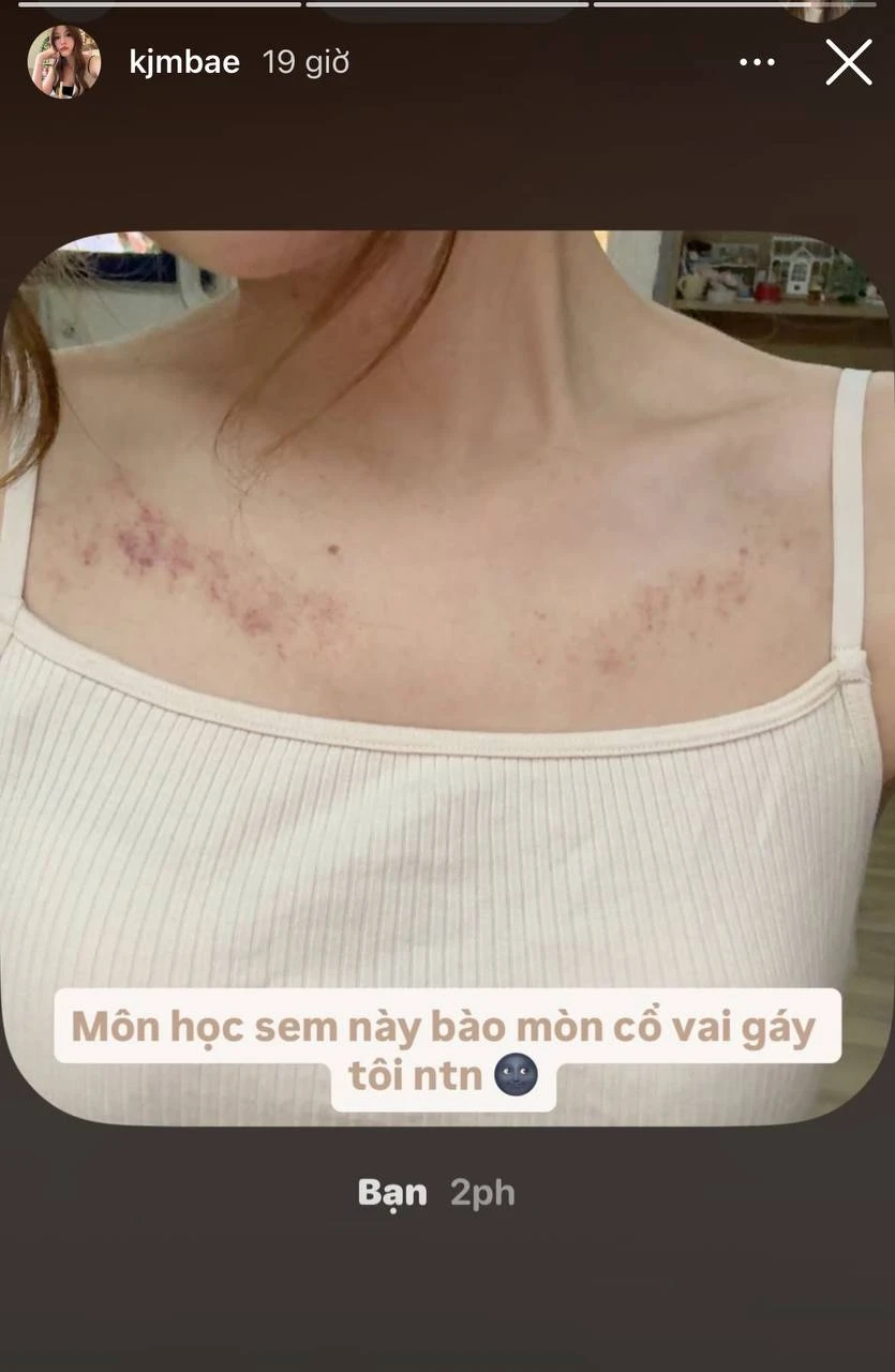HIEUTHUHAI và Tăng Mỹ Hàn chuyển địa điểm hẹn hò, lần này là trị liệu xương khớp HIEUTHUHAI và Tăng Mỹ Hàn chuyển địa điểm hẹn hò, lần này là trị liệu xương khớp