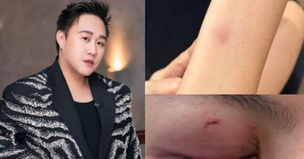 Mới nhất drama hành hung nữ bác sĩ: Trung Quân Idol thông báo ngưng hoạt động rồi xoá post sau 10 phút