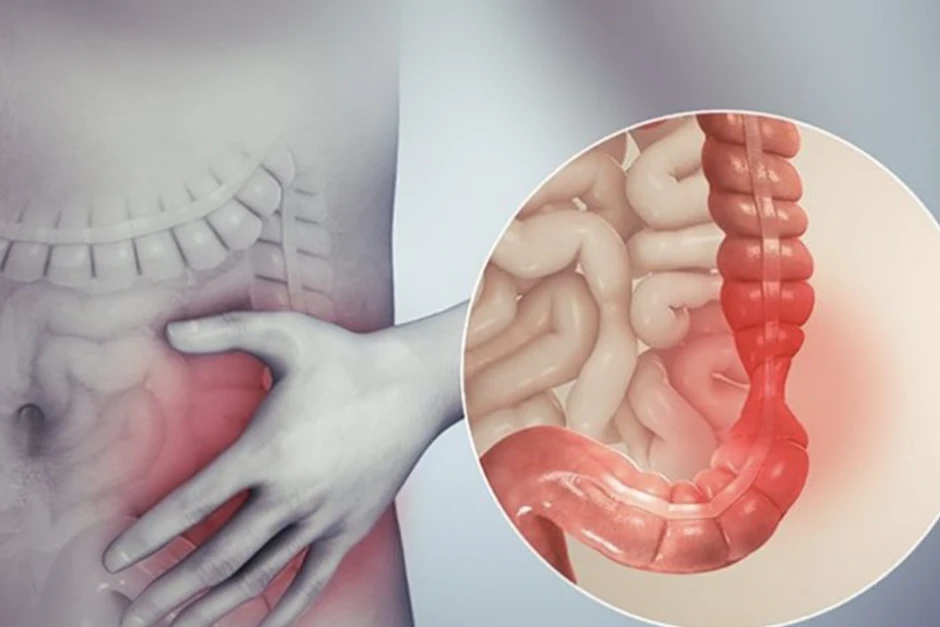 Nhiều người cứ ăn vào là đau bụng đi tiêu: Bệnh gì, chữa được không? Nhiều người cứ ăn vào là đau bụng đi tiêu: Bệnh gì, chữa được không?