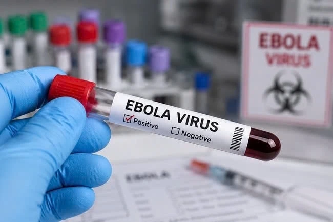 "2 phút vàng" khi khám bệnh có thể quyết định việc phát hiện ca nghi Ebola