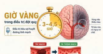 "Giờ vàng" đột quỵ: Ranh giới của hồi phục và tàn phế