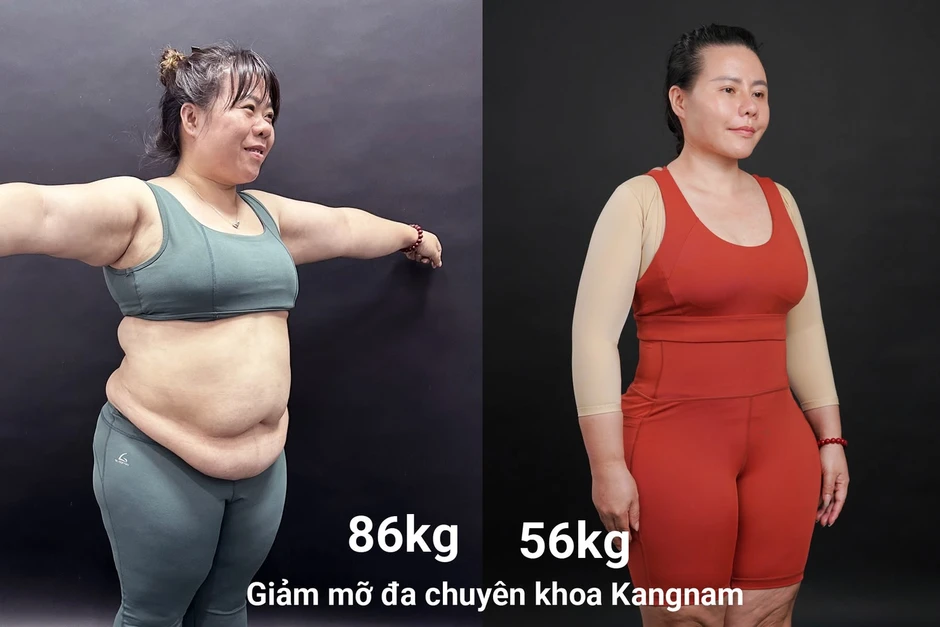 100 ngày thoát mỡ an toàn: "mẹ siêu nhân" hạnh phúc khi loại bỏ 30 kg mỡ 100 ngày thoát mỡ an toàn: "mẹ siêu nhân" hạnh phúc khi loại bỏ 30 kg mỡ