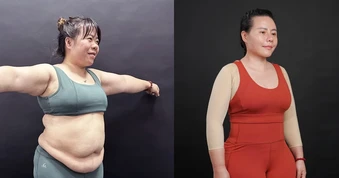 100 ngày thoát mỡ an toàn: "mẹ siêu nhân" hạnh phúc khi loại bỏ 30 kg mỡ