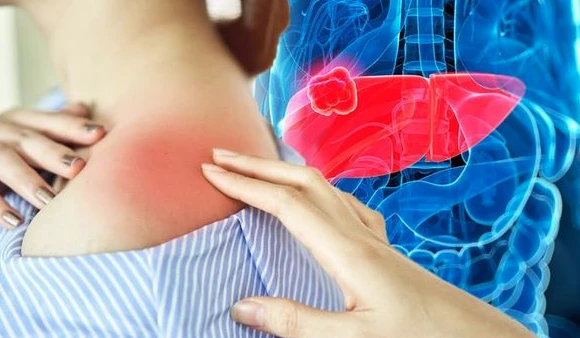 2 đau, 2 ngứa cảnh báo ung thư gan 2 đau, 2 ngứa cảnh báo ung thư gan
