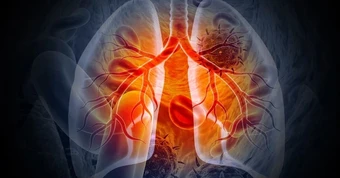 2 dấu hiệu ho tưởng nhẹ nhưng có thể là ung thư phổi: Có 1 cũng nên đi khám