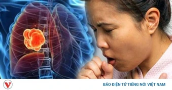 2 dấu hiệu khi ho cảnh báo ung thư phổi dễ bị bỏ qua