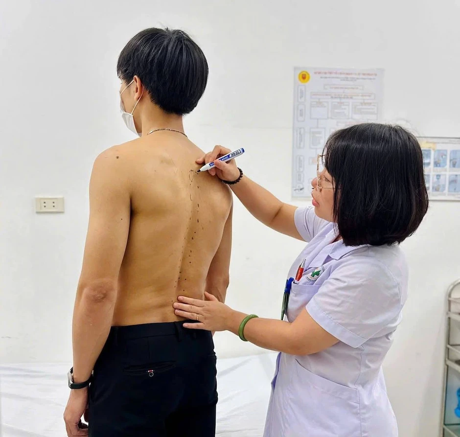 20 tuổi đã cứng cổ không thể xoay, 6 dấu hiệu đau lưng cần khám sớm 20 tuổi đã cứng cổ không thể xoay, 6 dấu hiệu đau lưng cần khám sớm
