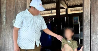 25 giáo viên, học sinh một điểm trường mắc thủy đậu