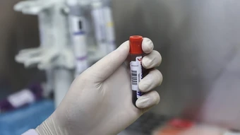 28 học sinh ngộ độc do nhiễm khuẩn Salmonella từ món trứng cuộn