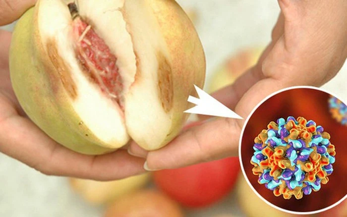 3 loại trái cây tế bào ung thư rất thích, có "bán rẻ như cho" cũng đừng động vào dù chỉ 1 lần! 3 loại trái cây tế bào ung thư rất thích, có "bán rẻ như cho" cũng đừng động vào dù chỉ 1 lần!
