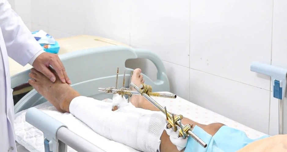 4 giờ căng thẳng giành lại đôi chân cho chàng trai bị tai nạn giao thông 4 giờ căng thẳng giành lại đôi chân cho chàng trai bị tai nạn giao thông